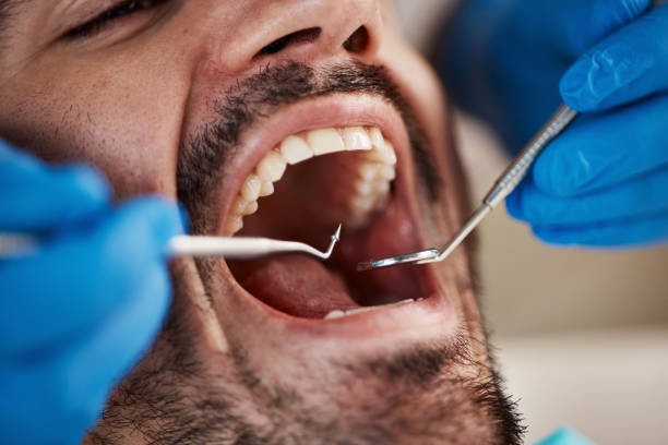 Best Emergency Dental Care for Trauma or Injury in University Heights, OH